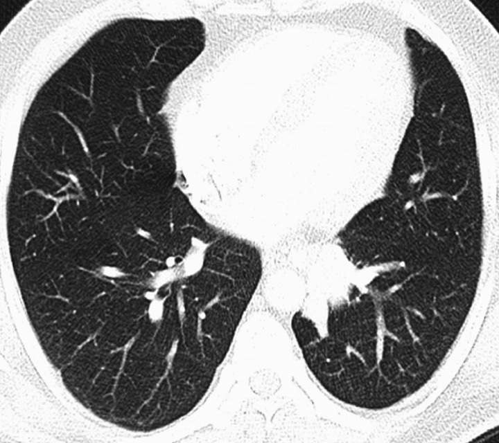 Figure 1c