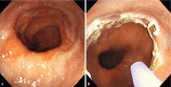 Fig. 1