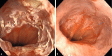 Fig. 2 a