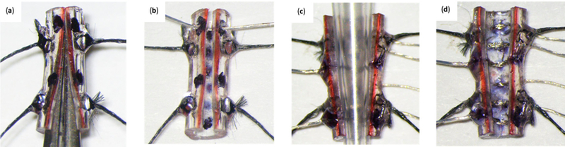 Figure 14.