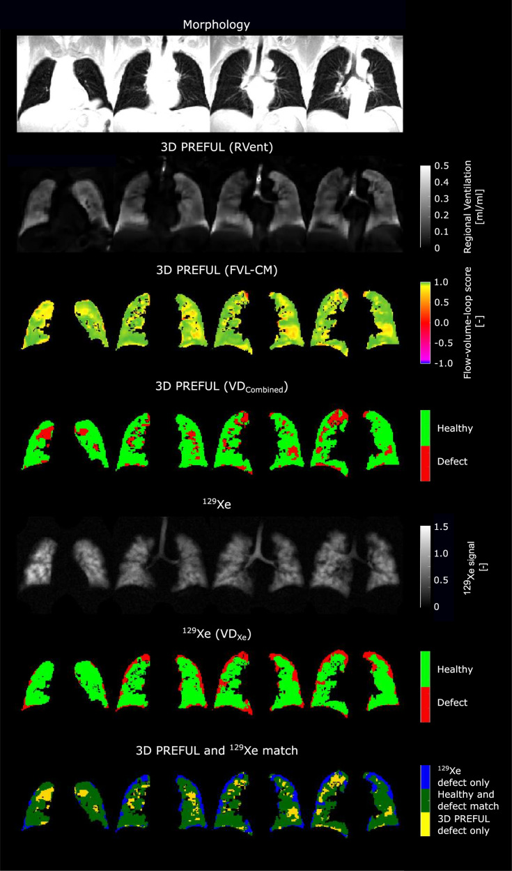 Fig. 6