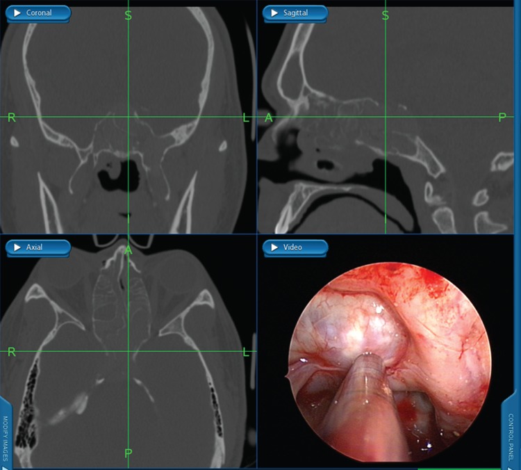 Figure 3.