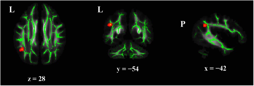 Figure 4.