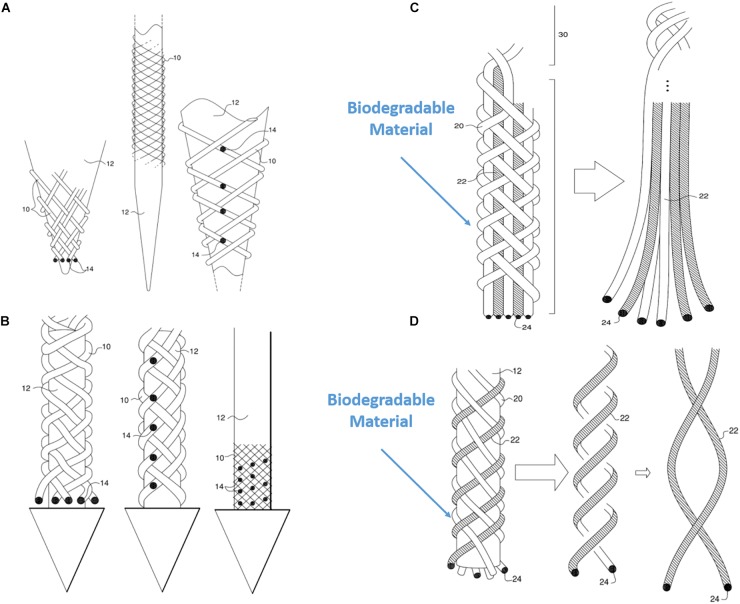 FIGURE 11