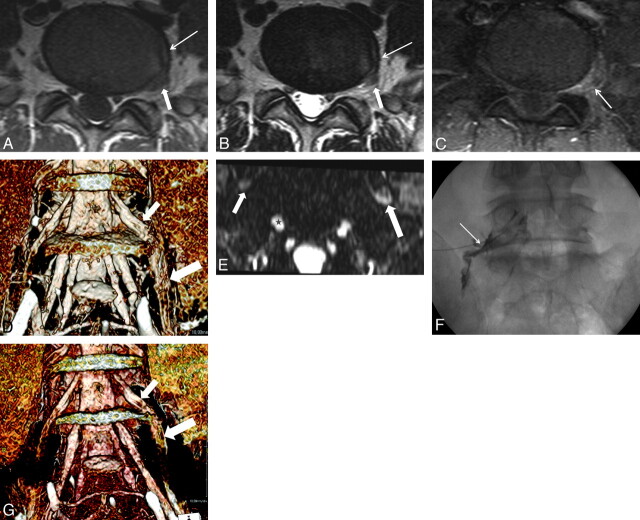 Fig 2.