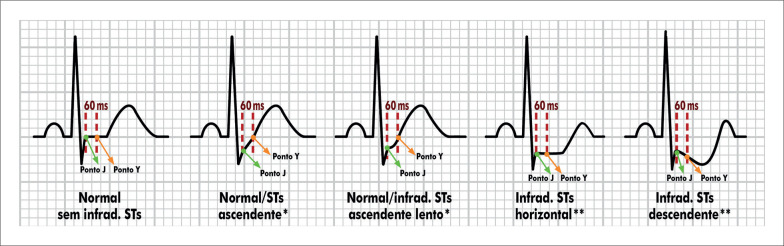 Figura 4