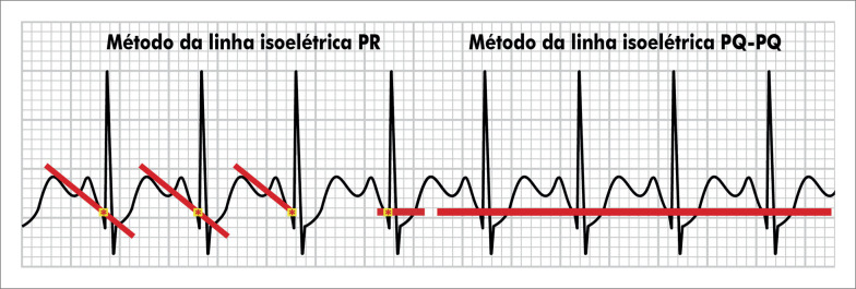 Figura 3