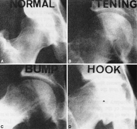 Fig. 1A–D