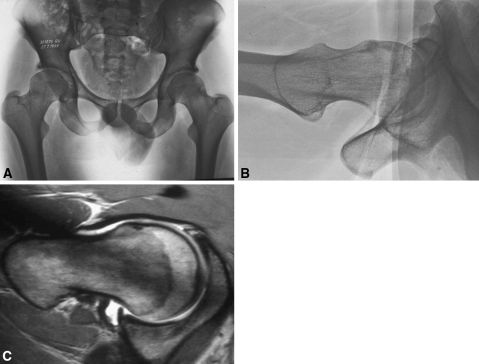 Fig. 3A–C