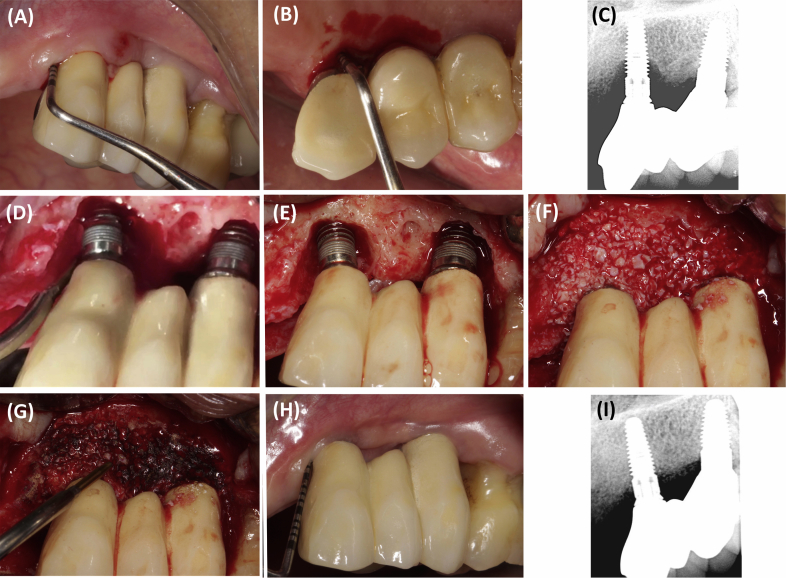 Figure 1