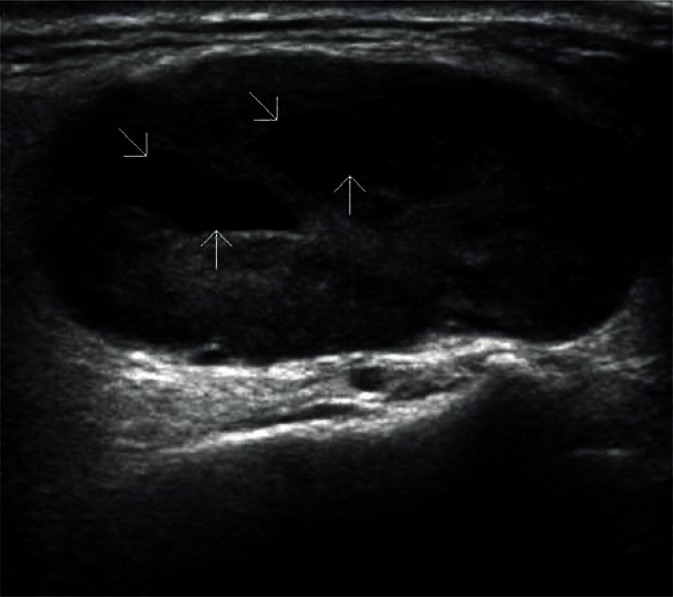 Fig. 14