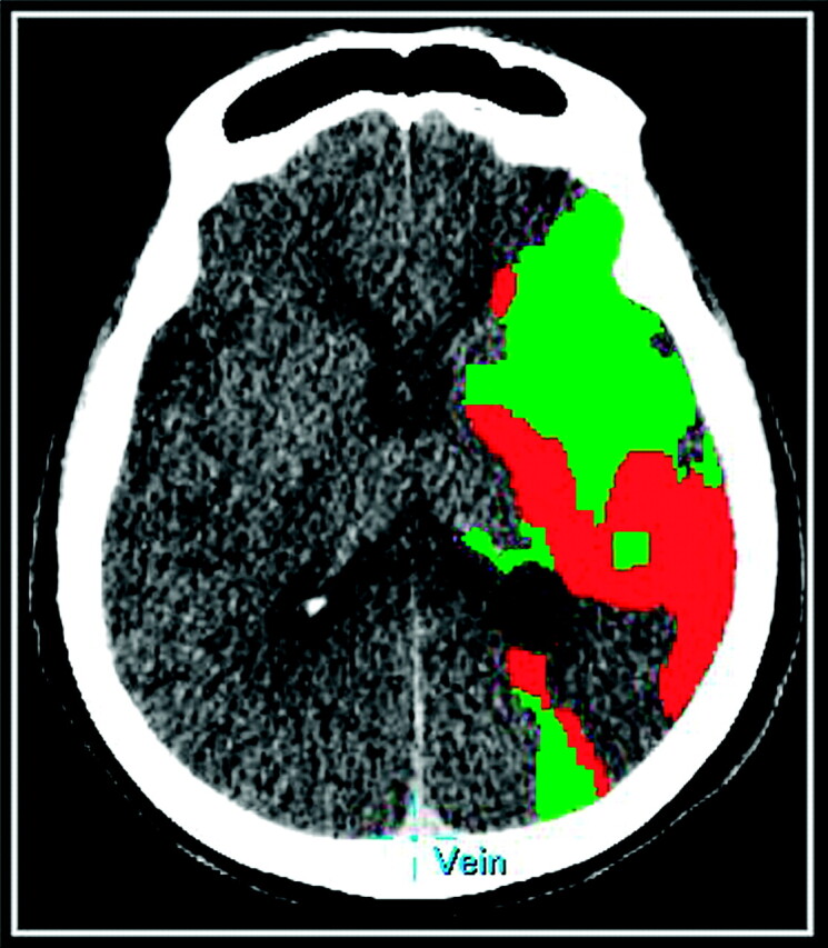 Fig 1.