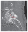 Fig. 3