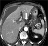 Figure 11:
