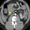 Figure 17: