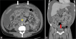 Figure 15: