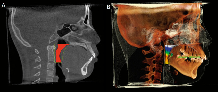 Figure 3.