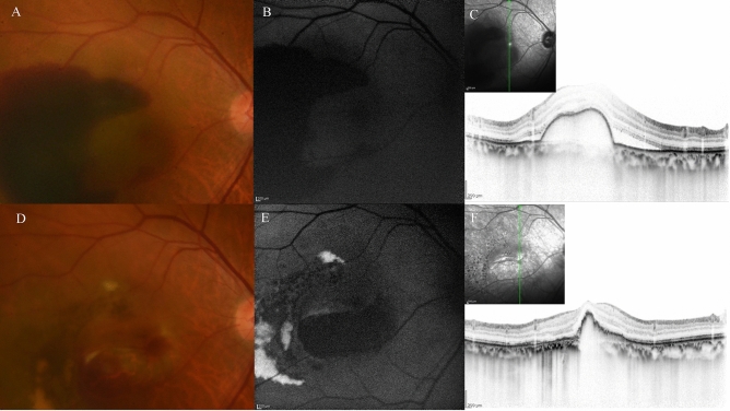 Figure 11