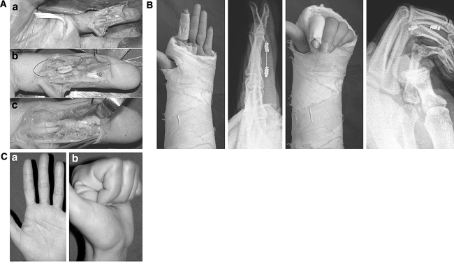 Fig. 2