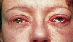 graphic file with name 978-3-662-48678-8_70_Fig2_HTML.jpg