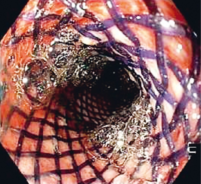 Fig. 3