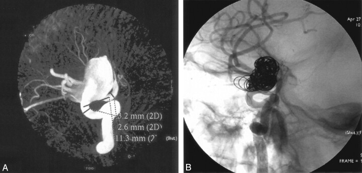 Fig 5.