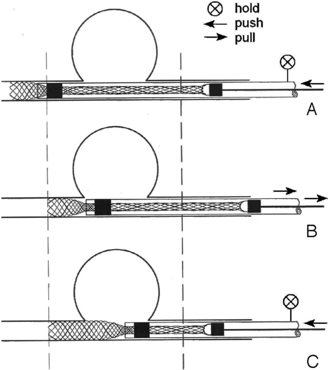 Fig 3.