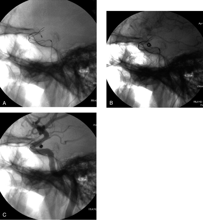 Fig 6.