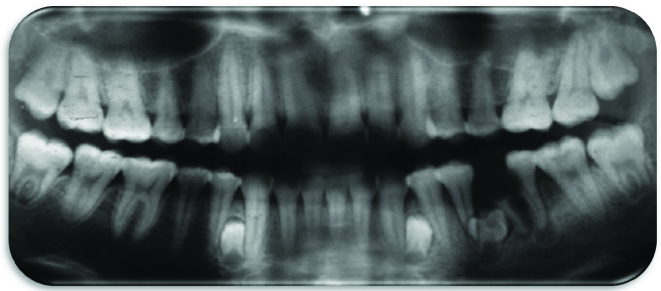 [Table/Fig-9]: