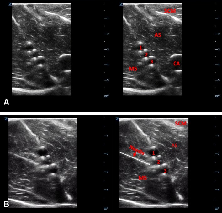 Fig. 12