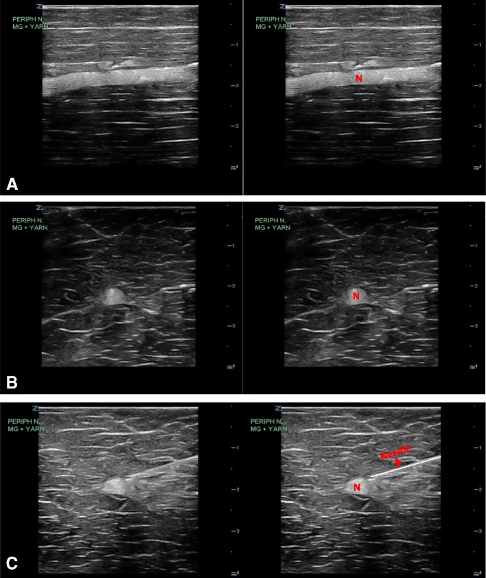 Fig. 10