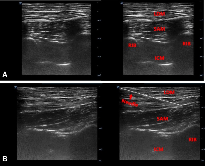 Fig. 13