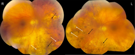 Fig. (1)