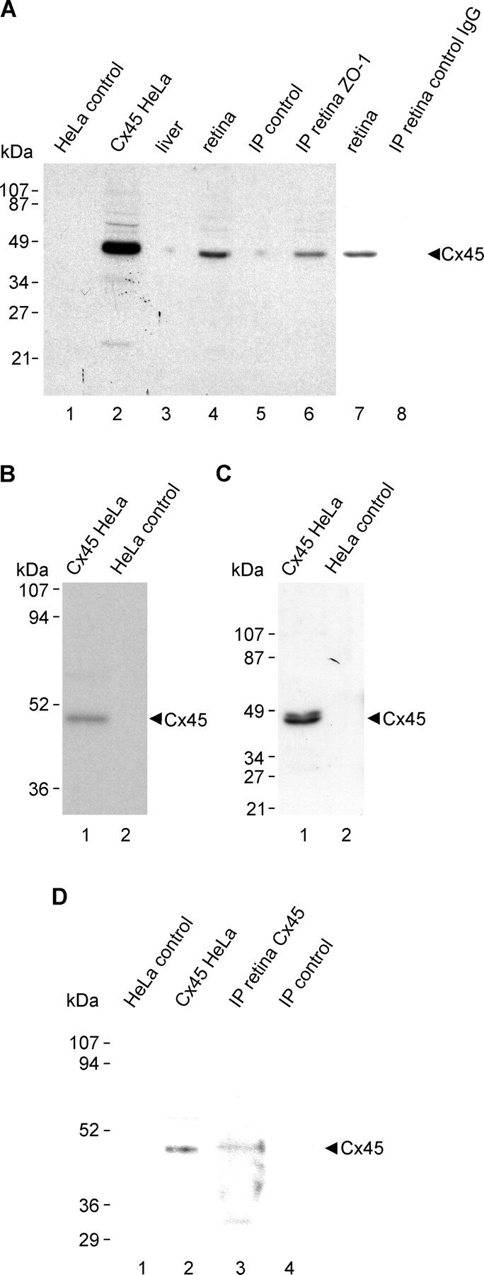 Figure 11.