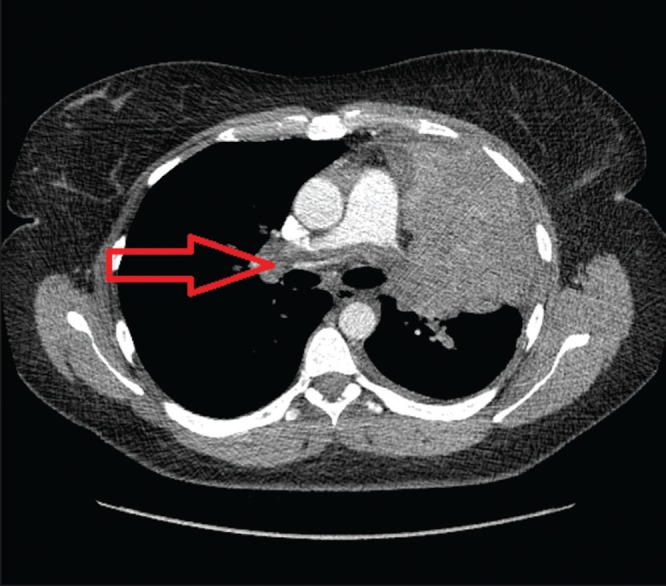 Figure 1)