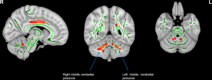 FIGURE 3