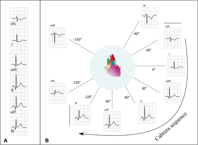 Why complicate an important task? An orderly display of the limb leads