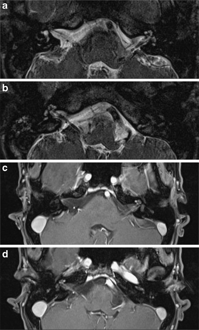 Fig. 10