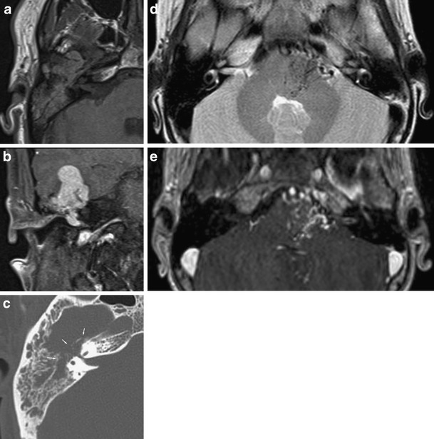 Fig. 14