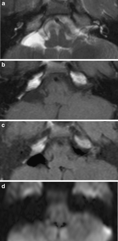 Fig. 17