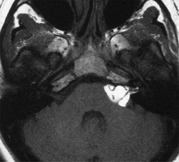 Fig. 13