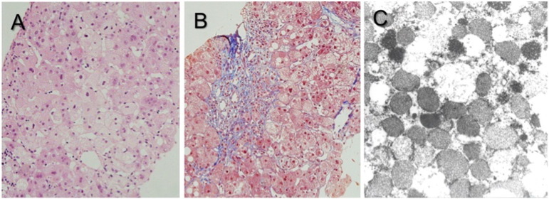 Fig. 1