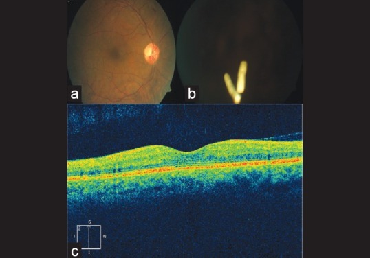 Figure 2