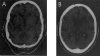 Figure  2