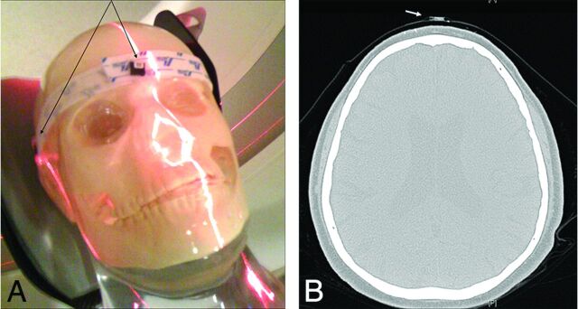 Fig 1.