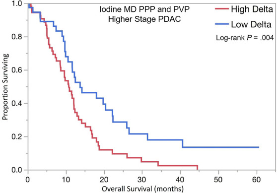 Kaplan-Meier curves for overall survival stratified by delta measured on dual-energy CT iodine material density (MD), pancreatic parenchymal phase (PPP), and conventional portal venous phase (PVP) images in patients with (a) lower stage pancreatic ductal adenocarcinoma (PDAC) and (b) higher stage PDAC. (c) Kaplan-Meier curve of distant metastasis–free survival stratified by delta measured on iodine MD PPP and PVP images.