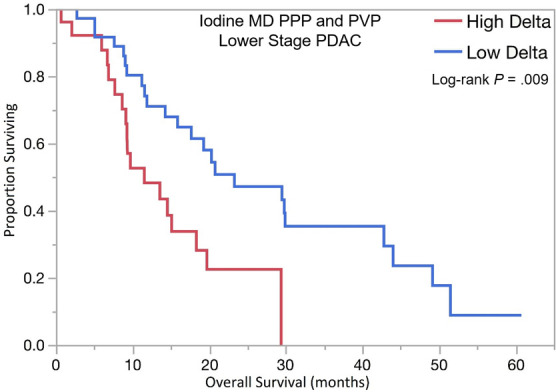 Kaplan-Meier curves for overall survival stratified by delta measured on dual-energy CT iodine material density (MD), pancreatic parenchymal phase (PPP), and conventional portal venous phase (PVP) images in patients with (a) lower stage pancreatic ductal adenocarcinoma (PDAC) and (b) higher stage PDAC. (c) Kaplan-Meier curve of distant metastasis–free survival stratified by delta measured on iodine MD PPP and PVP images.