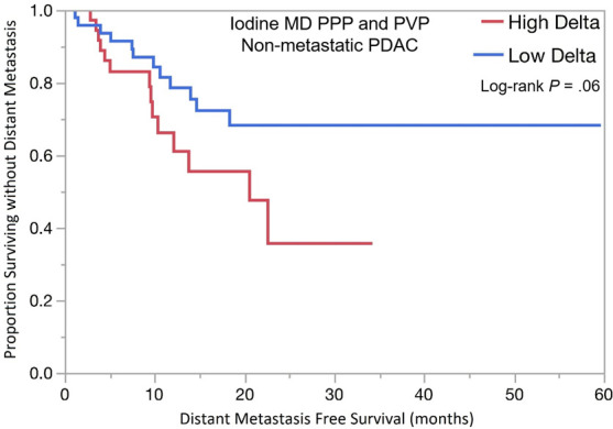 Kaplan-Meier curves for overall survival stratified by delta measured on dual-energy CT iodine material density (MD), pancreatic parenchymal phase (PPP), and conventional portal venous phase (PVP) images in patients with (a) lower stage pancreatic ductal adenocarcinoma (PDAC) and (b) higher stage PDAC. (c) Kaplan-Meier curve of distant metastasis–free survival stratified by delta measured on iodine MD PPP and PVP images.