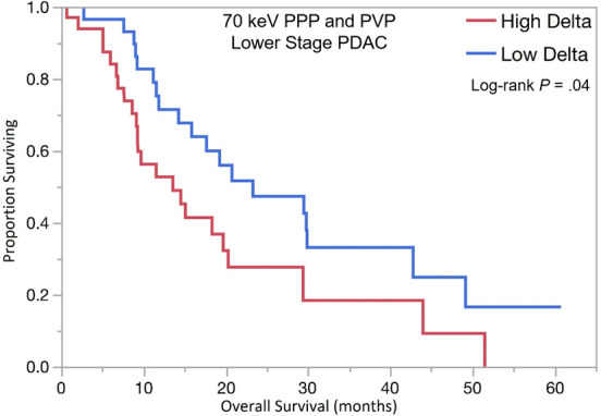 Kaplan-Meier curves for overall survival stratified by quantitative delta measured on dual-energy CT 70-keV pancreatic parenchymal phase (PPP) and conventional portal venous phase (PVP) images in patients with (a) lower stage and (b) higher stage pancreatic ductal adenocarcinoma (PDAC). (c) Kaplan-Meier curve of distant metastasis–free survival stratified by delta measured on 70-keV PPP and PVP.