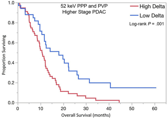 Kaplan-Meier curves for overall survival stratified by delta measured on dual-energy CT 52-keV pancreatic parenchymal phase (PPP) and conventional portal venous phase (PVP) images in patients with (a) lower stage and (b) higher stage pancreatic ductal adenocarcinoma (PDAC). (c) Kaplan-Meier curve of distant metastasis–free survival stratified by delta measured on 52-keV PPP and PVP.